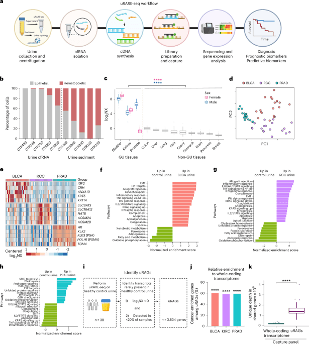 Urine cell-free RNA for bladder cancer detection and treatment response prediction