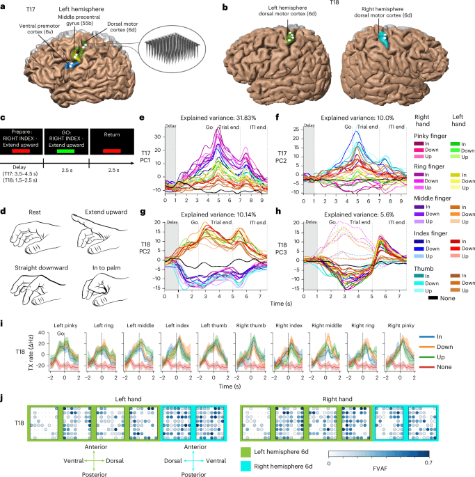 Restoring rapid natural bimanual typing with a neuroprosthesis after paralysis
